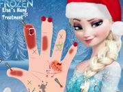 Elsa's Hand Treatment