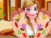 Frozen Anna Foot Doctor